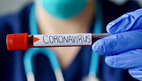 U Srbiji preminula 61 osoba, 17.851 novozaražena