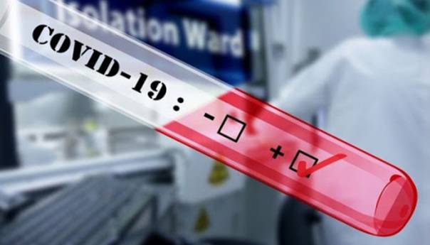 U Srbiji preminule još tri osobe od koronavirusa