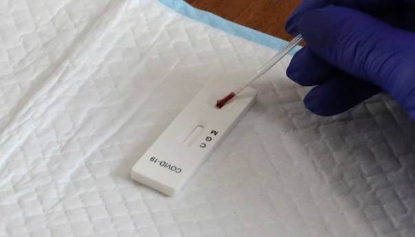 U Tuzli još jedna osoba zaražena koronavirusom