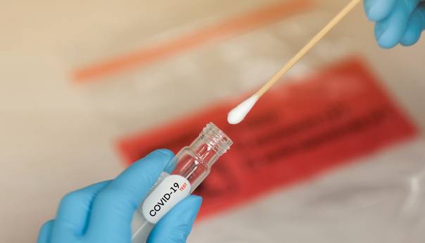 U ZDK za sedam dana potvrđeno 30 novih slučajeva virusa korona