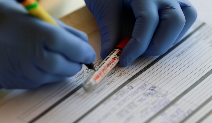 U ZHK-u 70 oporavljenih od ukupno 78 zaraženih