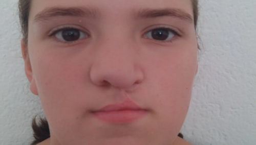 Udruženje Pomozi.ba pokrenulo apel za 10-godišnju Zerinu iz Busovače