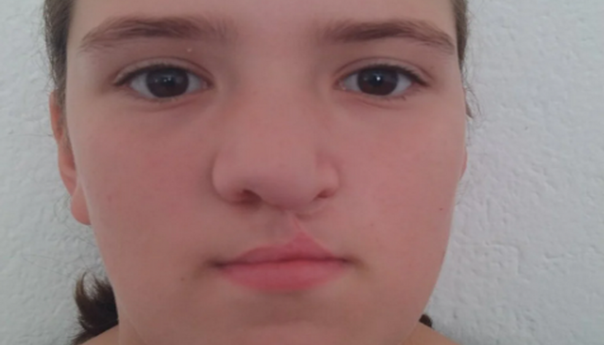 Udruženje Pomozi.ba pokrenulo apel za 10-godišnju Zerinu iz Busovače