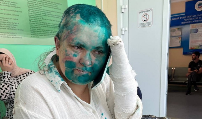Ugledna ruska novinarka i advokat napadnuti i pretučeni u Čečeniji