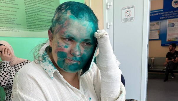 Ugledna ruska novinarka i advokat napadnuti i pretučeni u Čečeniji