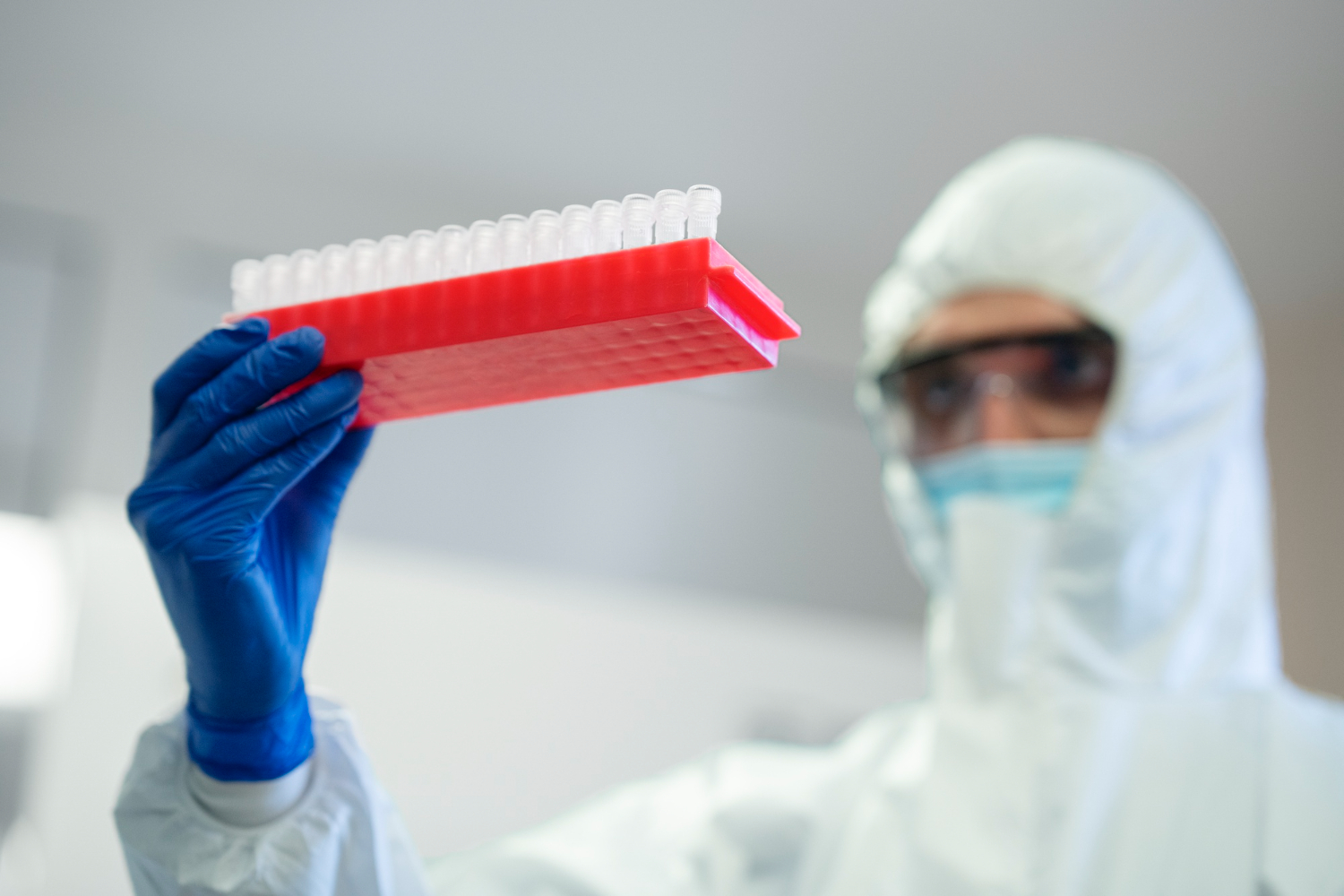 Ukupno 71 prijavljeni slučaj leptospiroze od početka epidemije