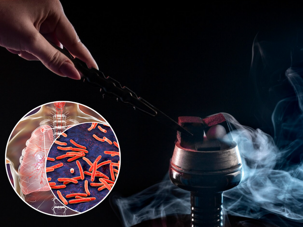 Upotreba nargila dovela do porasta broja mladih oboljelih od tuberkuloze