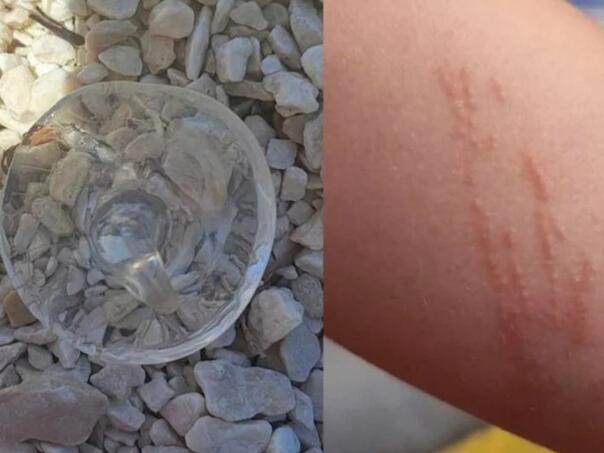 Upozorenje za plivače na Jadranu: 'Svako malo nam djeca izlaze iz mora opečena'