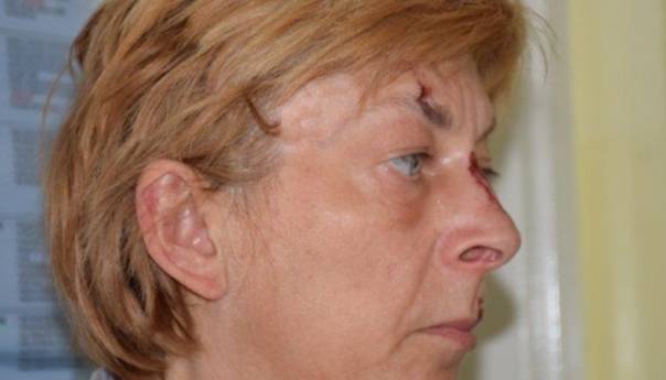 Utvrđen identitet žene pronađene na Krku