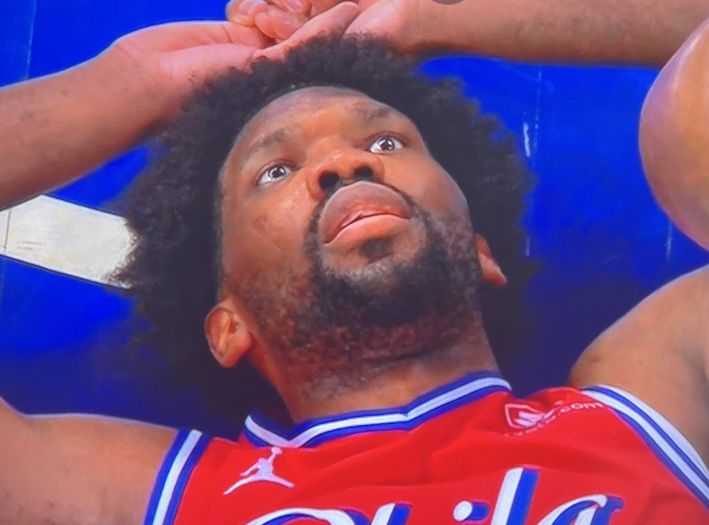 Velika NBA zvijezda otkrila da ima rijetku bolest lica