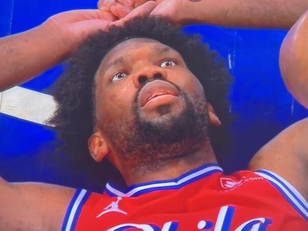 Velika NBA zvijezda otkrila da ima rijetku bolest lica