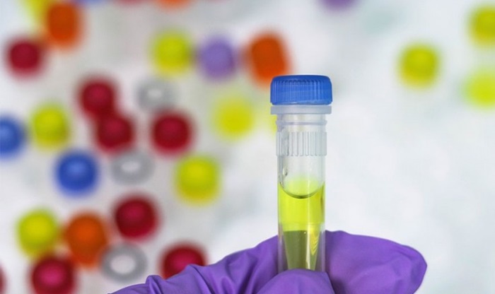 Veliko interesovanje Beograđana za PCR testiranje na lični zahtjev