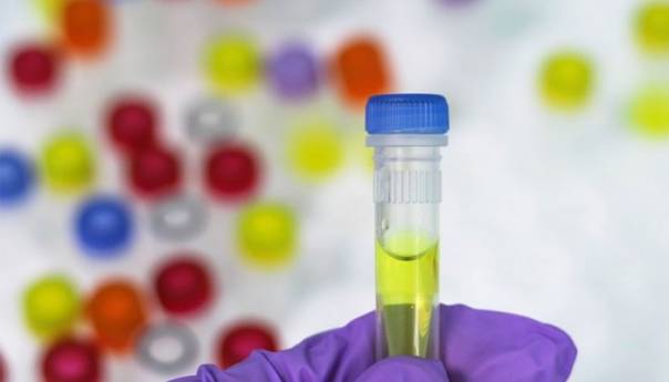 Veliko interesovanje Beograđana za PCR testiranje na lični zahtjev