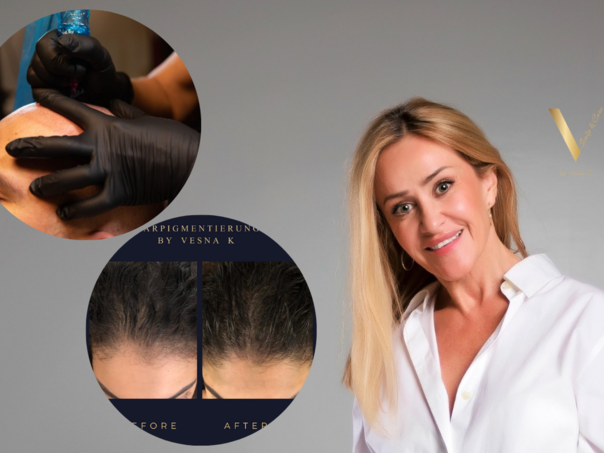 Vesna Kljajić uskoro u Sarajevu: Pigmentacija kose je rješenje i za ćelavost