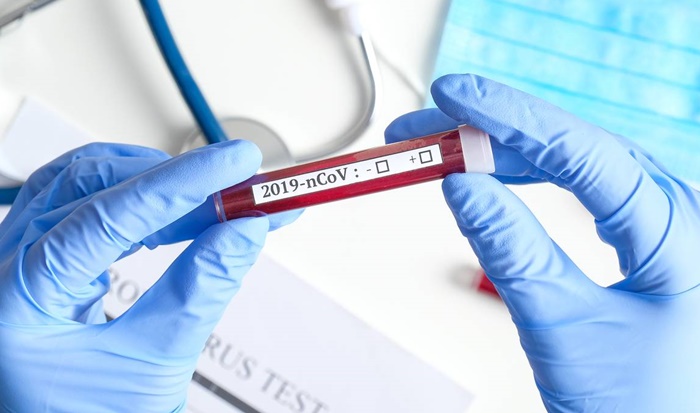 Virus je u Hrvatsku stigao mutiran iz Austrije ili sjeverne Italije