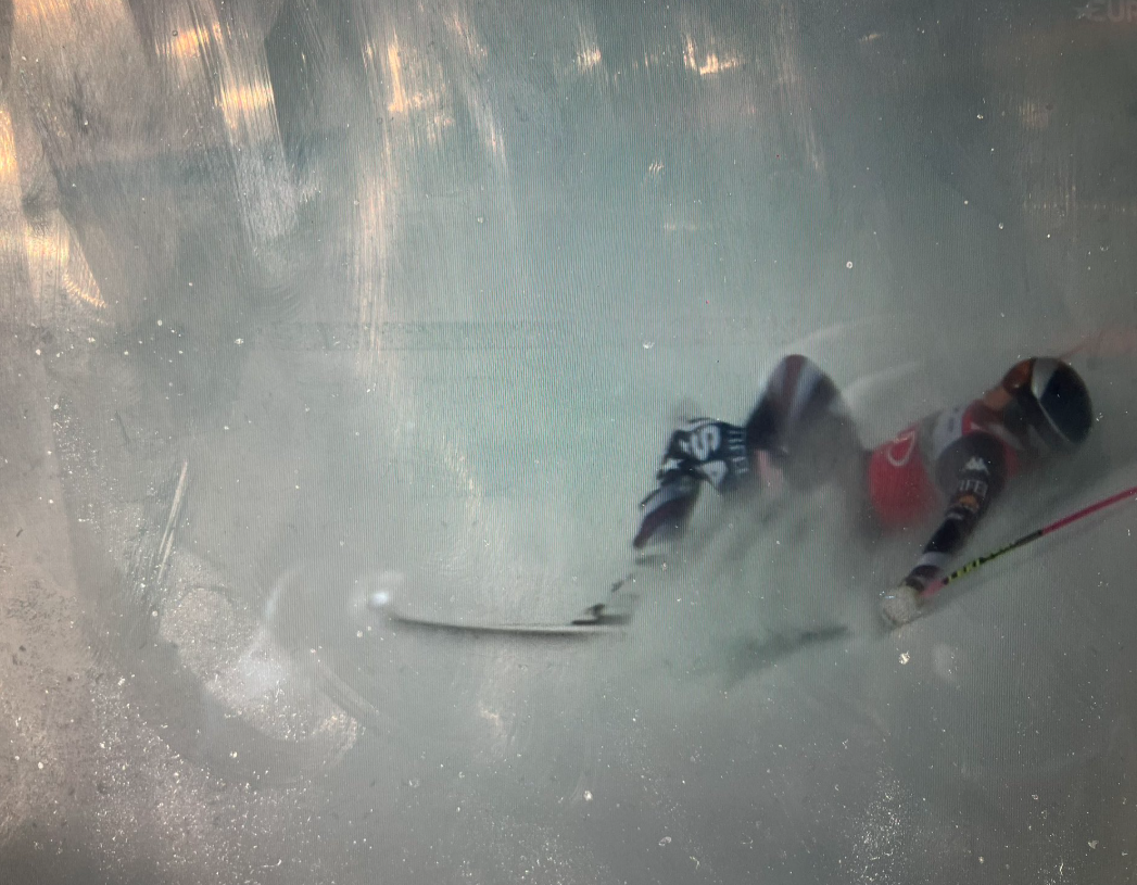 Vonn: Borit ću se svim silama za nastup na OI