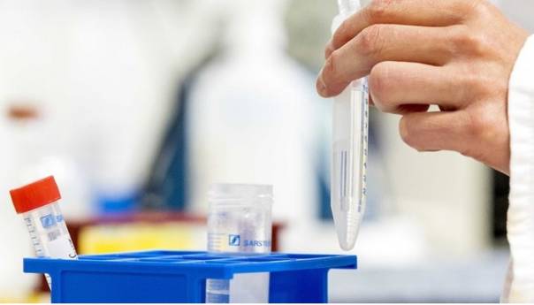 WHO i 30 zemalja pokreću inicijativu: "Neka liječenje koronavirusa bude javno dobro"