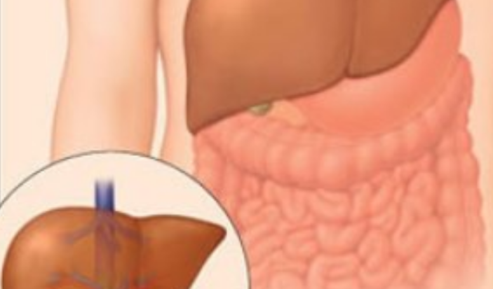 WHO: Misteriozna bolest razara dječiju jetru