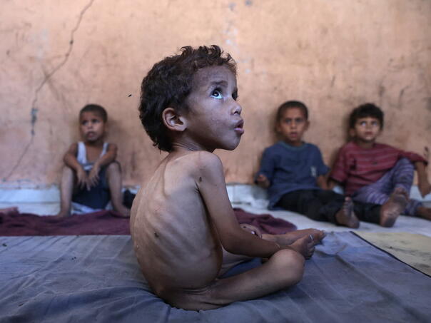 WHO: Od pothranjenosti umrlo 148 Palestinaca u Gazi zbog izraelske blokade pomoći