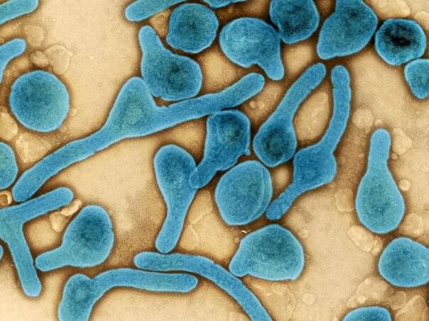 WHO: Osam osoba umrlo u Tanzaniji sa sumnjom na virus Marburg