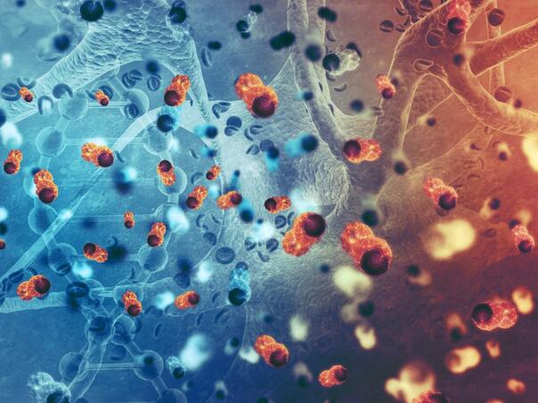 "Zaboravljeni" karcinom se sve češće javlja kod mladih ljudi