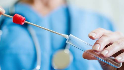 Zaraženi imaju slabiju kliničku sliku