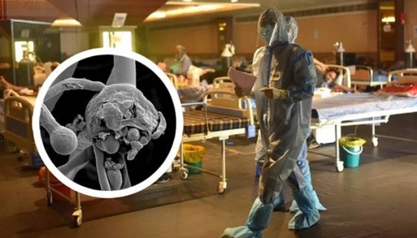 Zaraženi u Indiji dobivaju i opaku crnu gljivicu