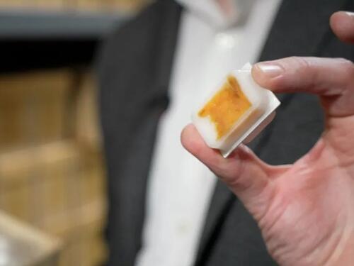 Stari uzorci: Zašto rak debelog crijeva pogađa sve mlađe?