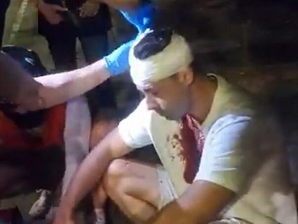 Zastupniku SSP-a razbijena glava na protestima u Beogradu