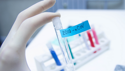 Žena iz Tešnja zaražena koronavirusom je srodnica prvozaraženog koji je bio u Italiji