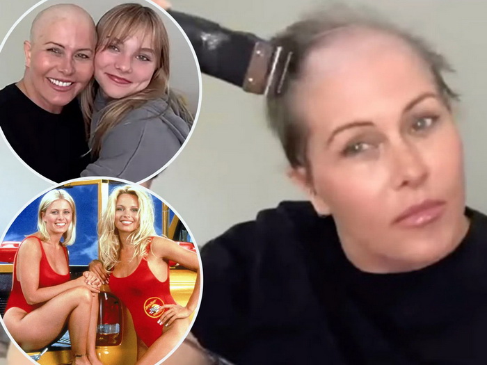 Zvijezda Baywatcha uslijed borbe s rakom obrijala glavu