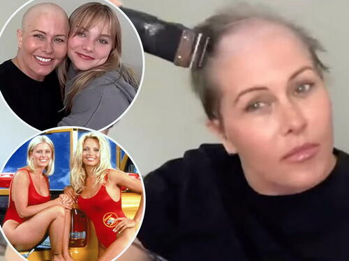 Zvijezda Baywatcha uslijed borbe s rakom obrijala glavu